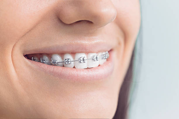 Best Dental Bonding  in Middletown, IN